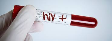 OTKRIVENA STRAŠNA ISTINA: Krv zaražena HIV-om i hepatitisom C korišćena u ispitivanjima na deci!